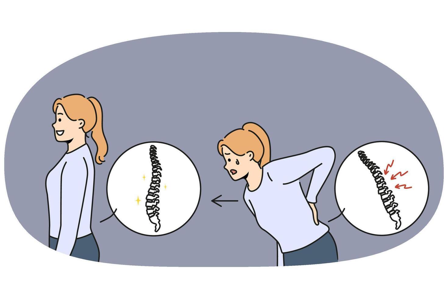 Woman with sick spine near healthy girl with good posture who underwent chiropractic procedure vector