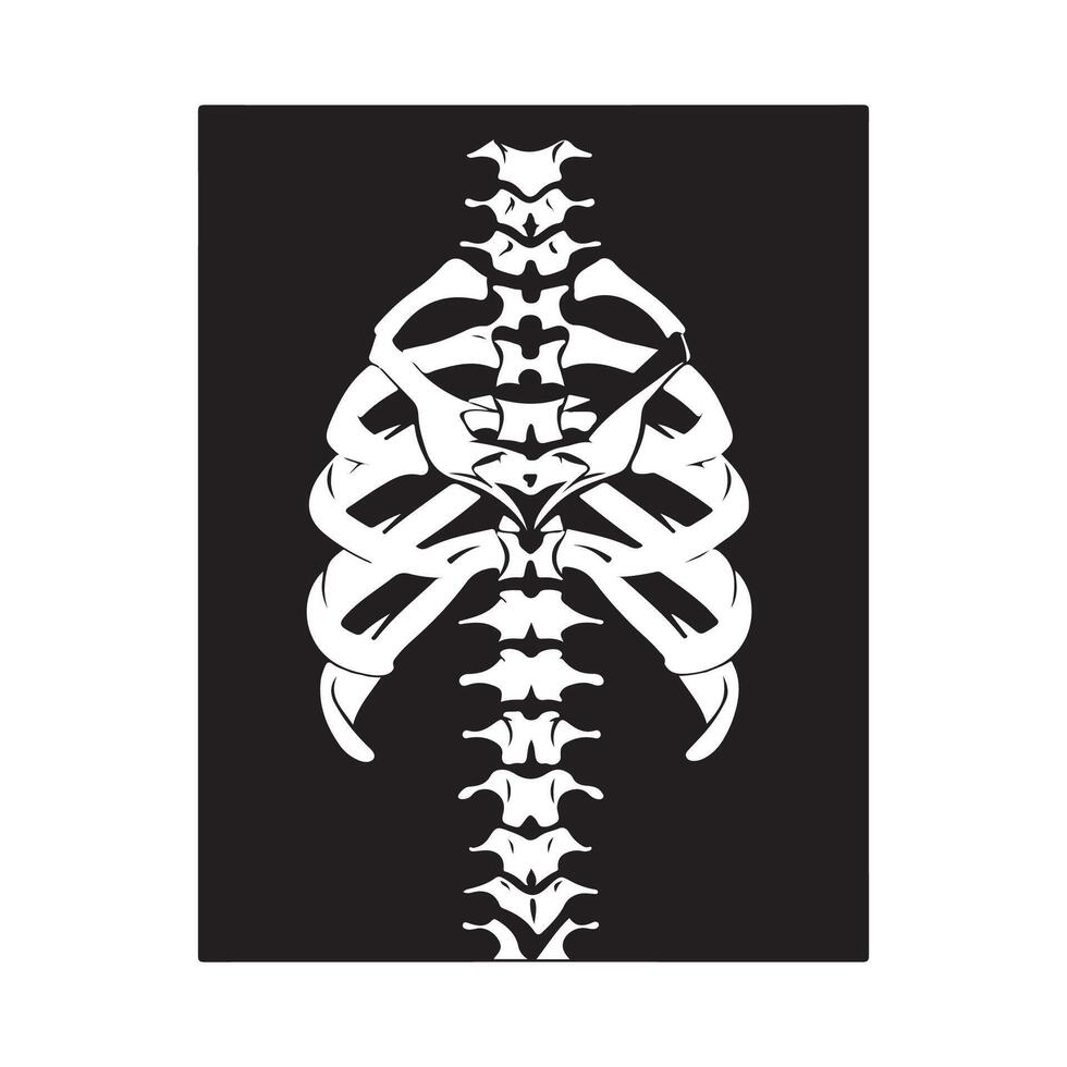 Osteoporosis illustration logo icon design Black and White Stock vector