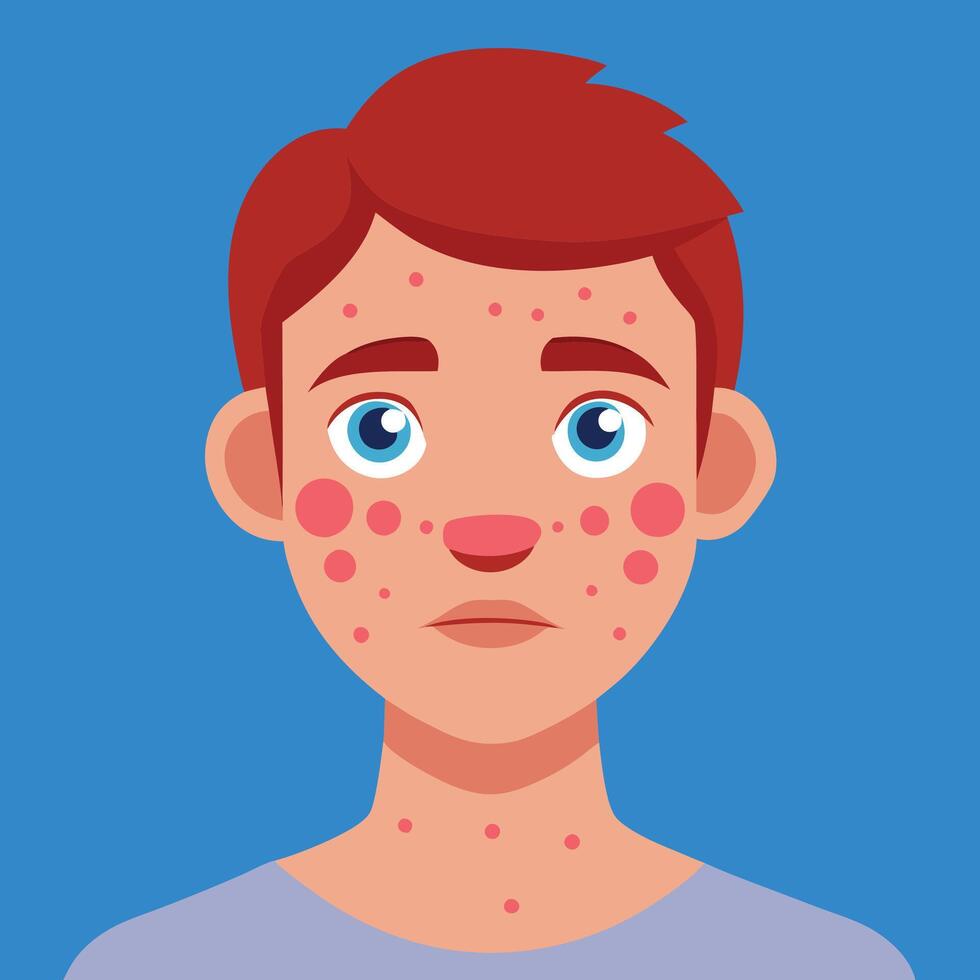 A boy with acne on his face vector
