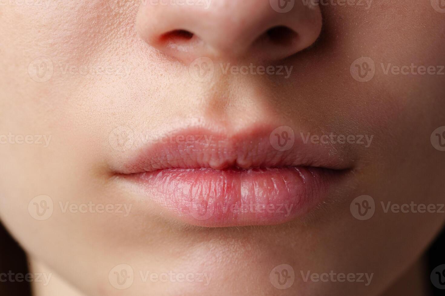 Close Up of a Woman's Lips With Dry Skin photo