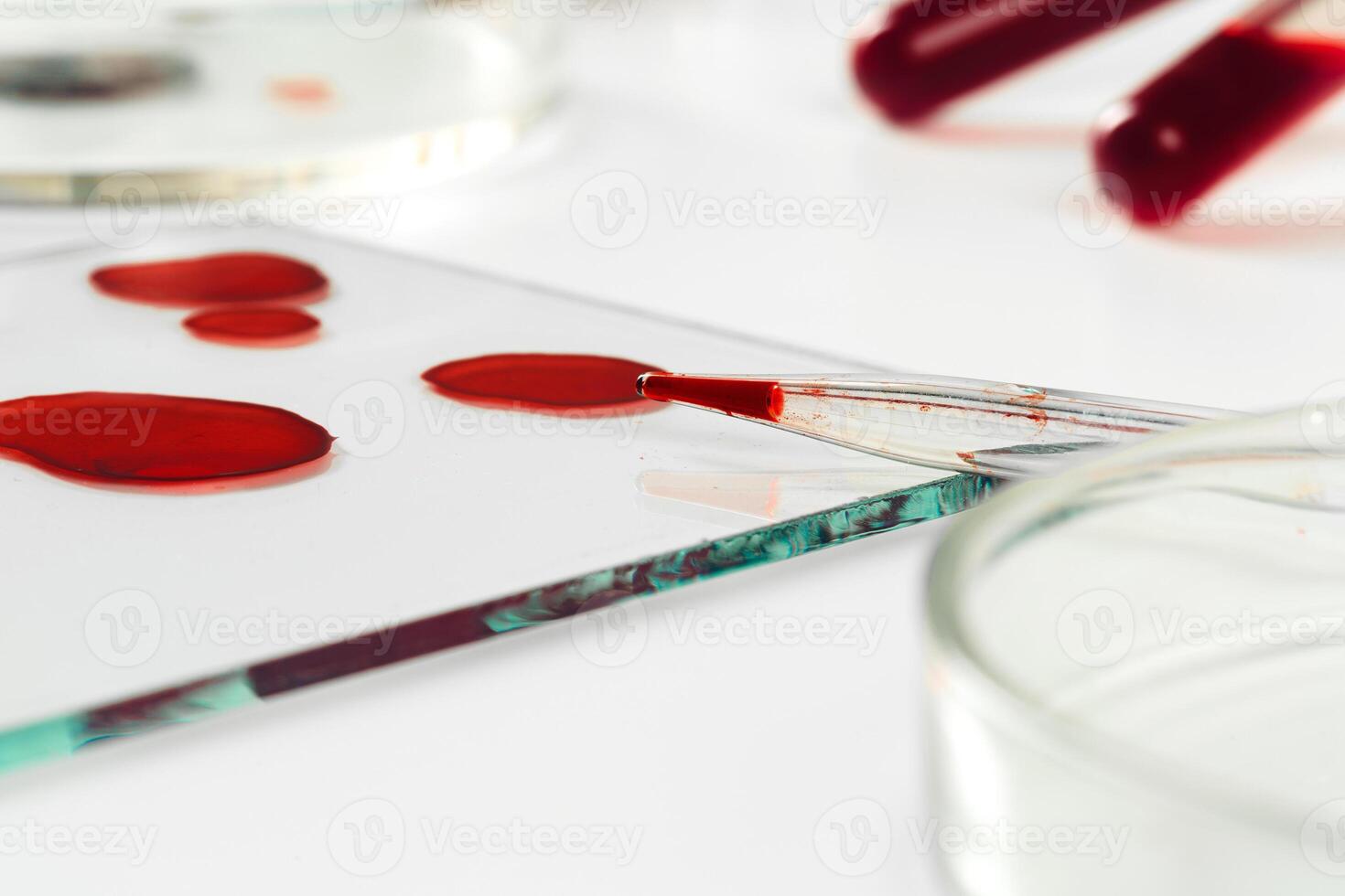 Blood test analysis with Petri dish close up photo