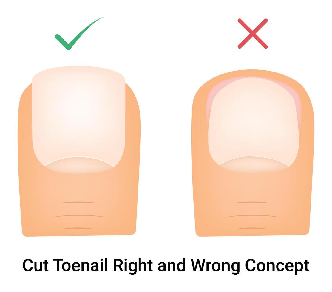 Cut Tonail Right and Wrong Concept Science Design Illustration Diagram vector