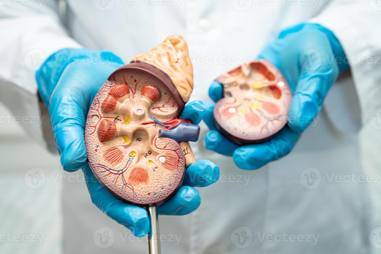 Kidney disease, Chronic kidney disease ckd, Doctor hold human model to treat and study in hospital. photo