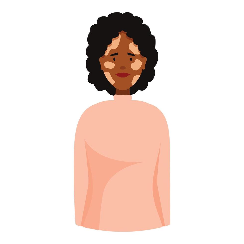 Young black woman with vitiligo smiling and posing for portrait vector