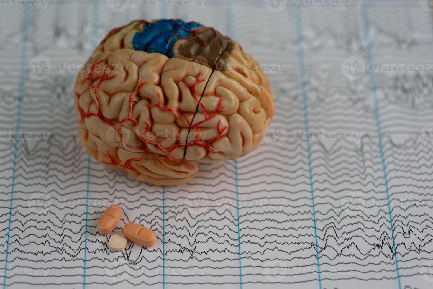 Brain model with antiepileptic medication on EEG photo