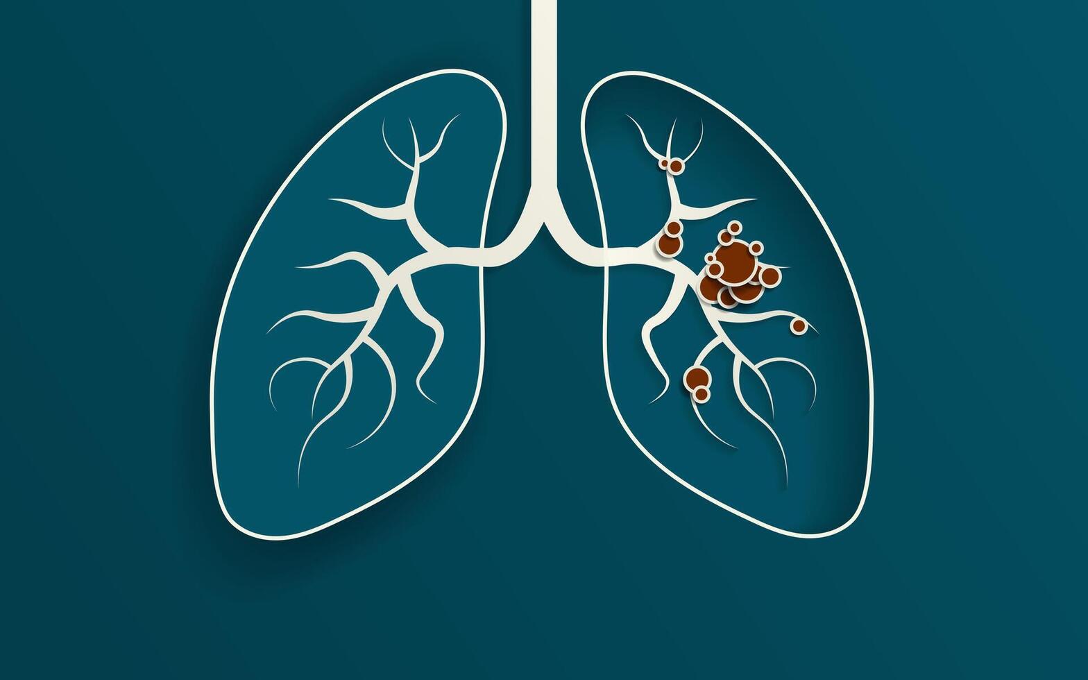 Simple 3D Paper Cut out Illustration of the human lungs. Left lung popped out above surface with shadow, right lung hollowed into background with floating lung bronchus and red tumor cells. vector