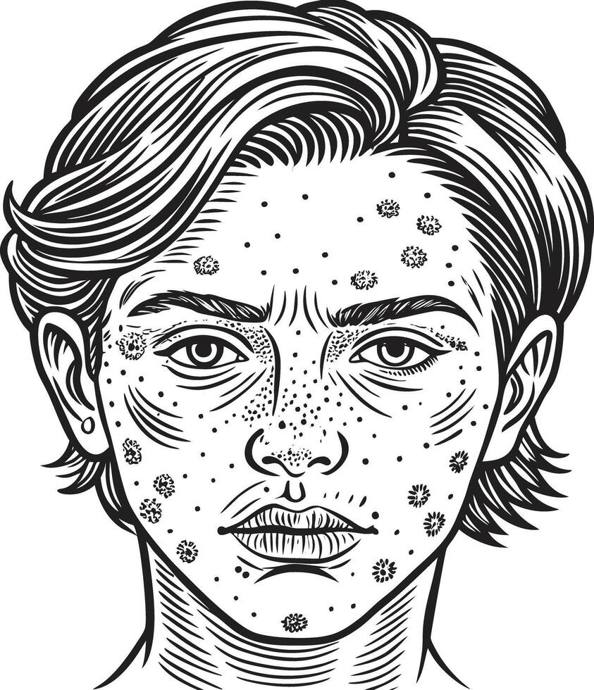 A man with acne on his face vector
