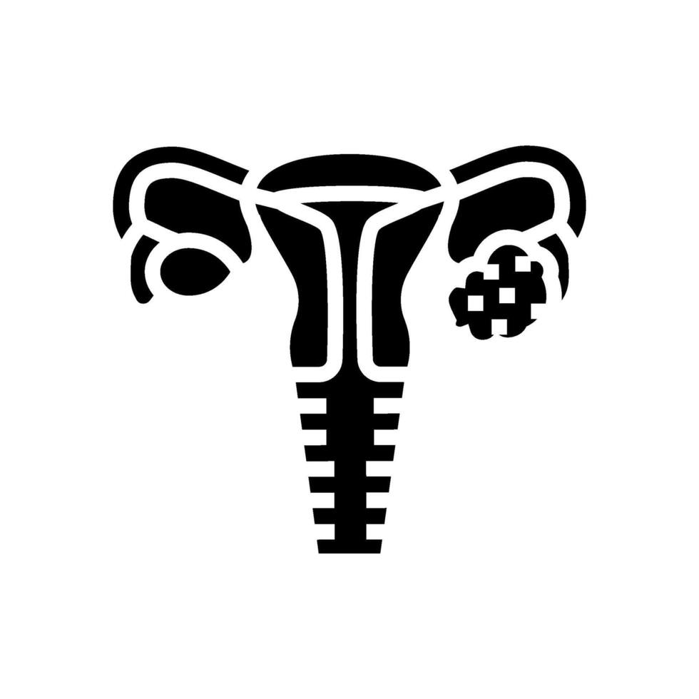 polycystic ovary syndrome woman disease glyph icon illustration vector