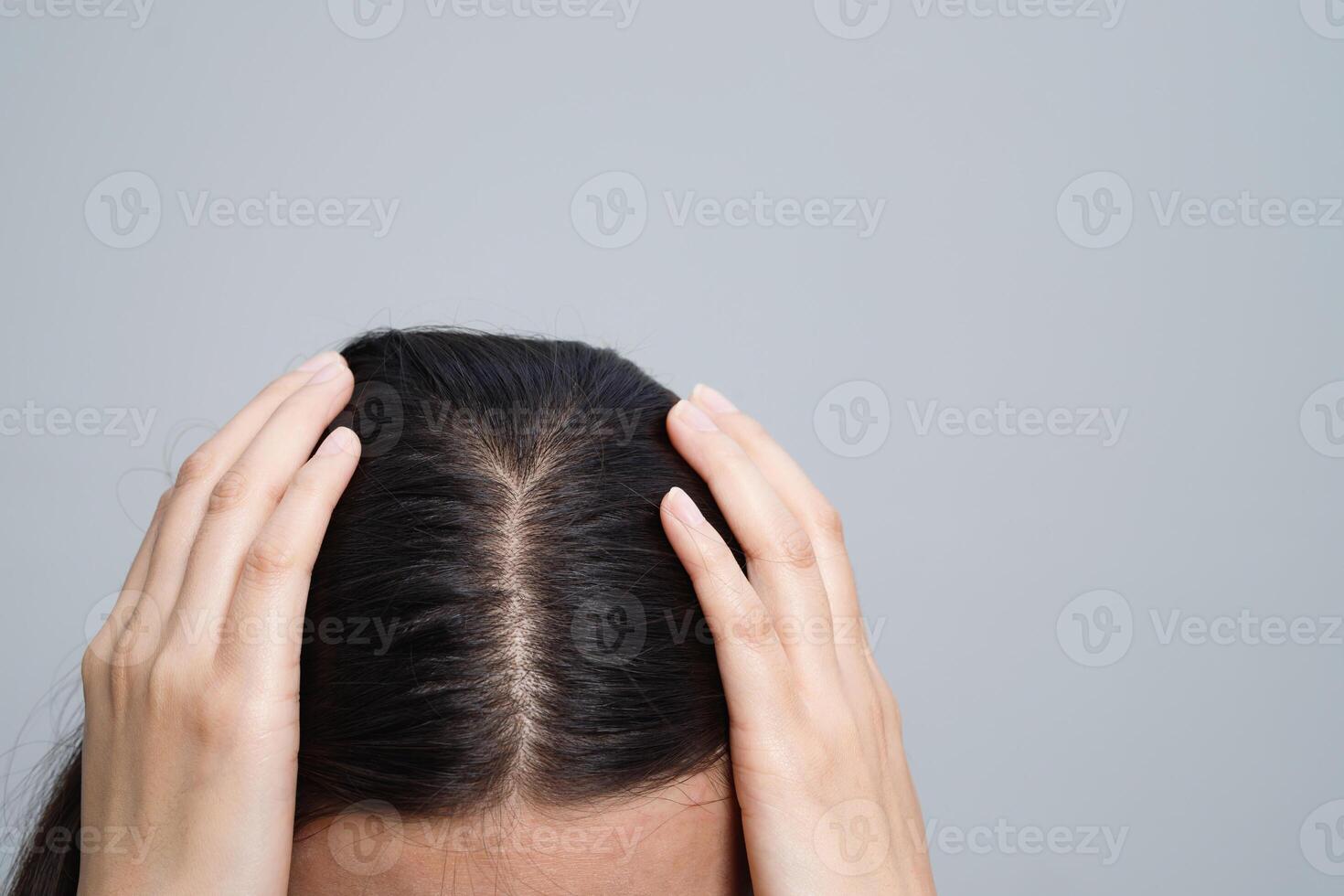 A woman has a problem with hair loss. photo