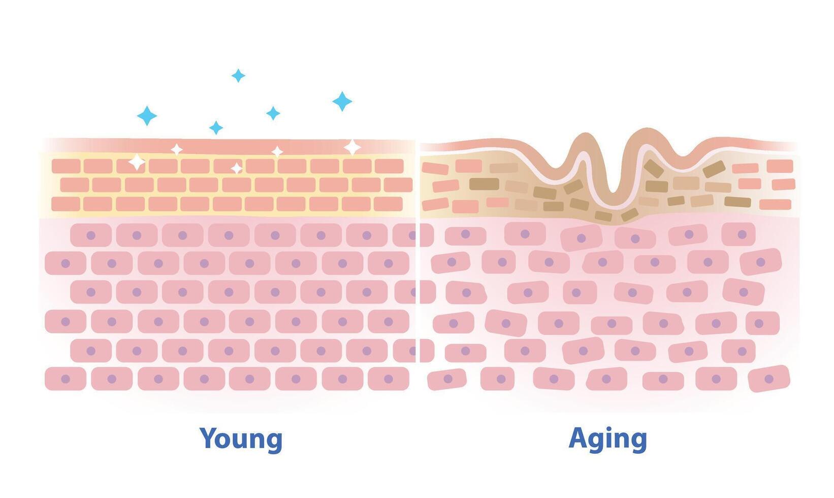 Comparison of young and aging skin illustration isolated on white background. Cross section of healthy and wrinkle that lose strength, flexibility and firmness on structure skin layer. vector