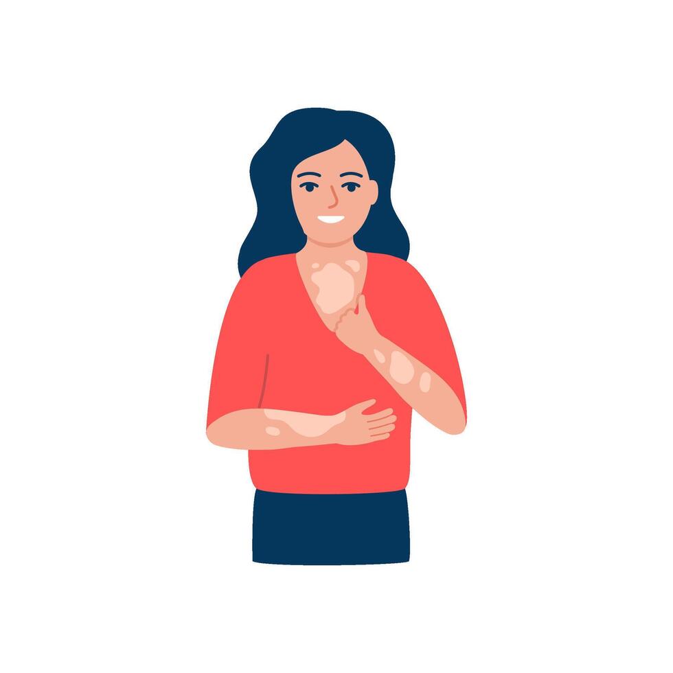 Vitiligo on skin of happy young woman. Body with area pigmentation different color. Self love and self care. Autoimmune disease illustration vector
