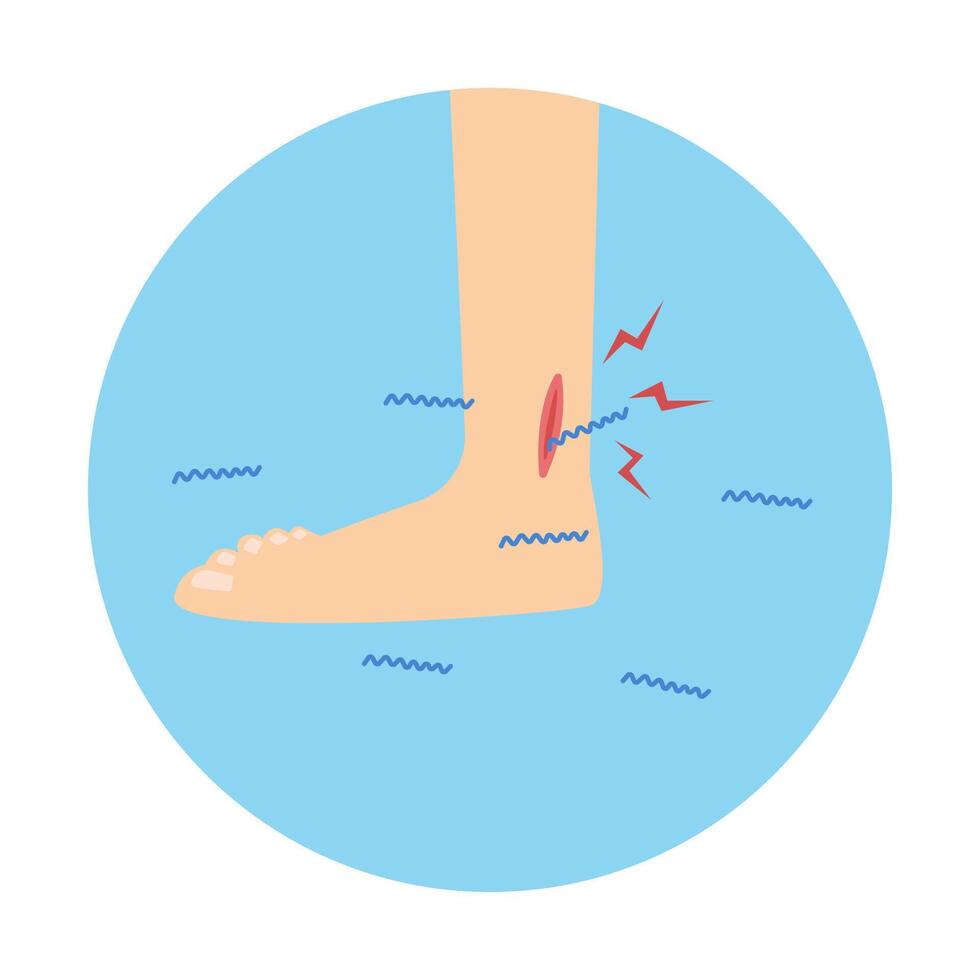leptospirosis infection disease from leptospira bacteria in rat urine vector