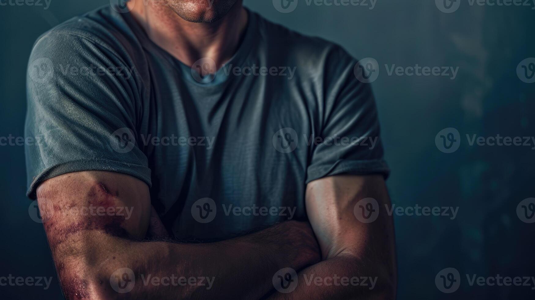 A man with bruises on his arms a sign of his struggle with addiction and determination to overcome the physical and emotional toll of withdrawal photo
