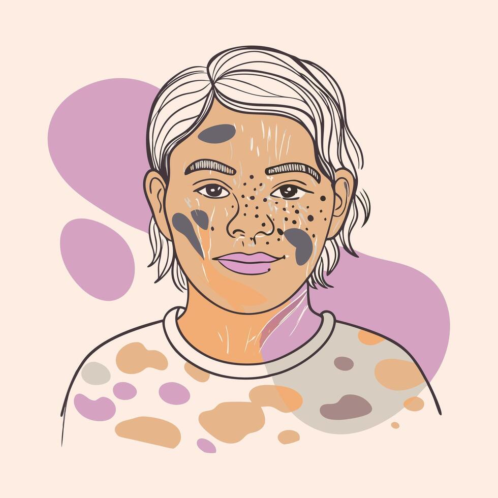 Illustration of a woman with acne vector