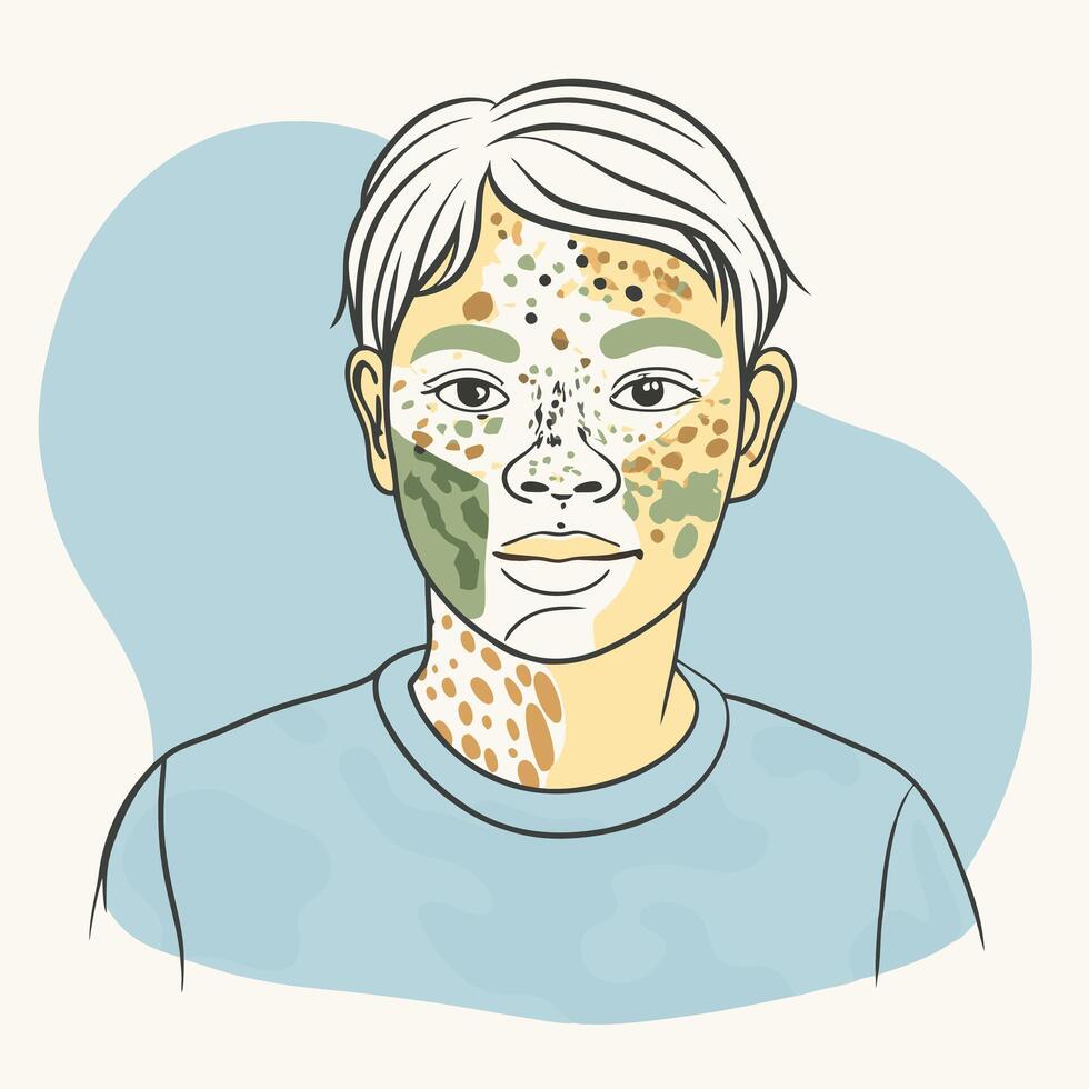 Illustration of a boy with acne vector