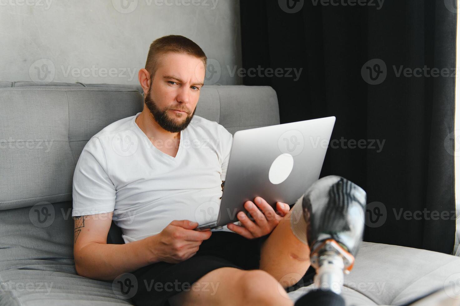 Man amputee with prosthetic leg disability on above knee transfemoral leg prosthesis artificial device using laptop at home. People with amputation disabilities everyday life photo
