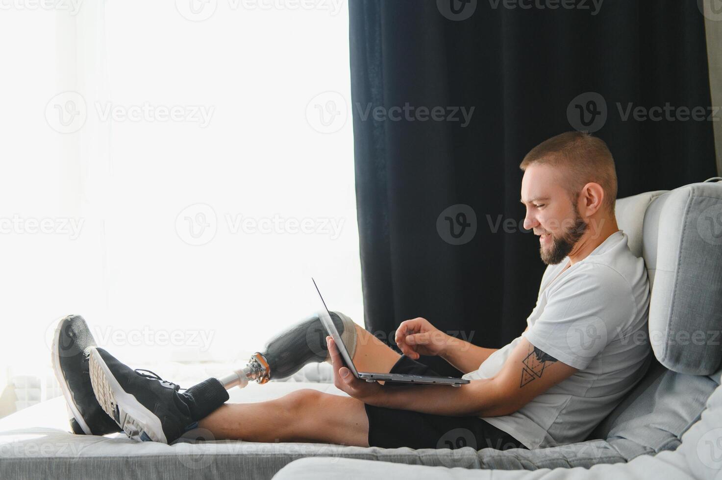 Man amputee with prosthetic leg disability on above knee transfemoral leg prosthesis artificial device using laptop at home. People with amputation disabilities everyday life photo