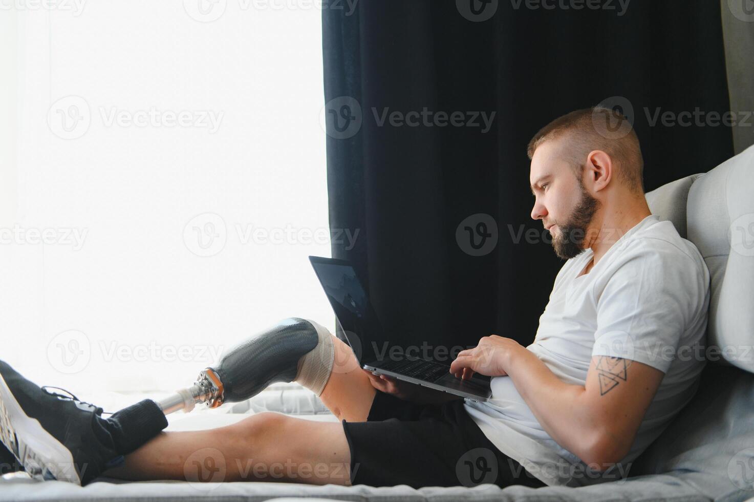 Man amputee with prosthetic leg disability on above knee transfemoral leg prosthesis artificial device at home. People with amputation disabilities everyday life photo