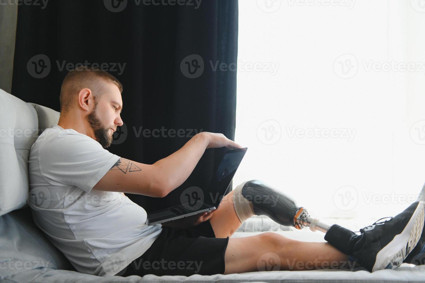 Man amputee with prosthetic leg disability on above knee transfemoral leg prosthesis artificial device using laptop at home. People with amputation disabilities everyday life photo