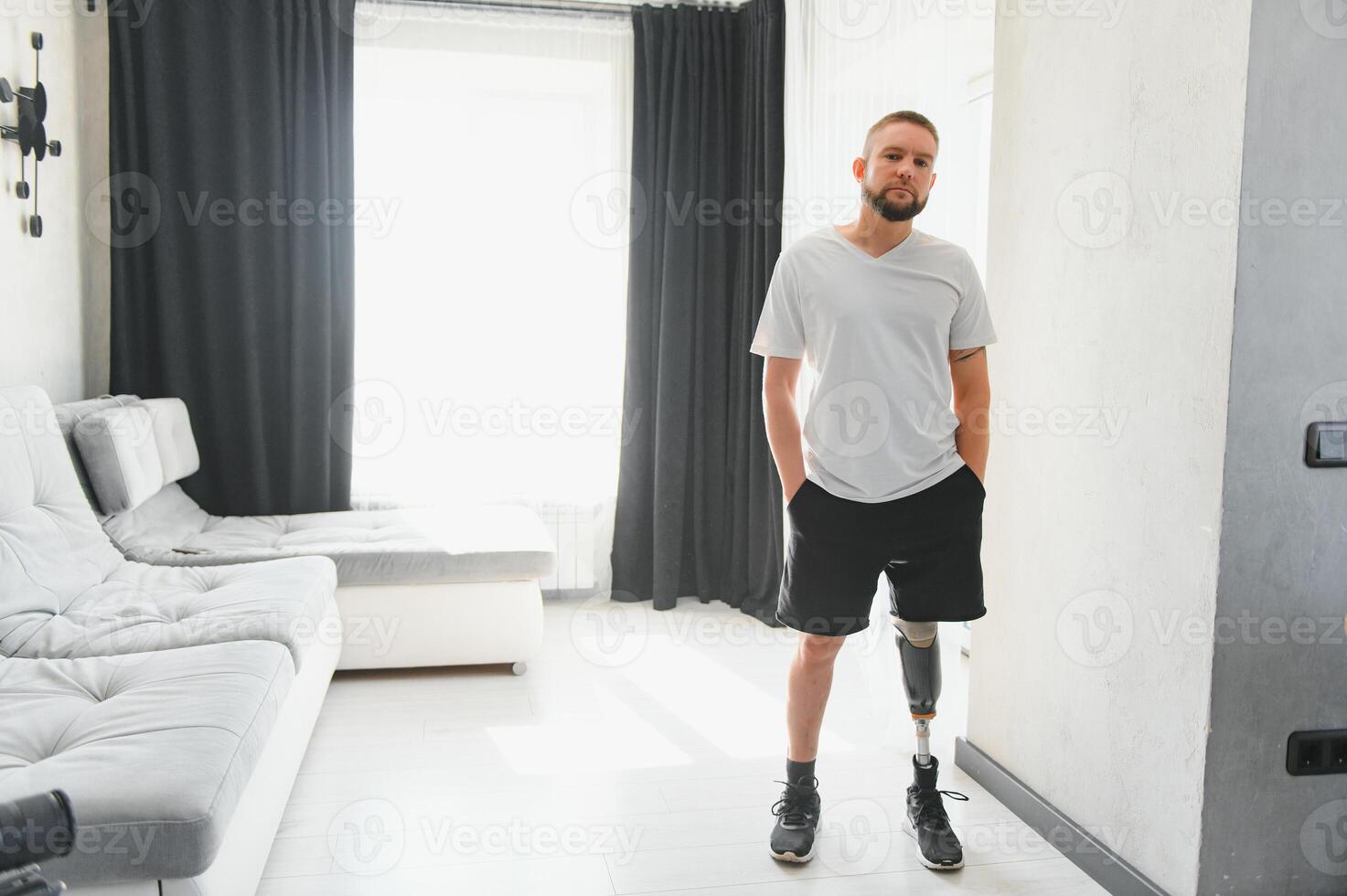 Man amputee with prosthetic leg disability on above knee transfemoral leg prosthesis artificial device, close up. People with amputation disabilities everyday life photo