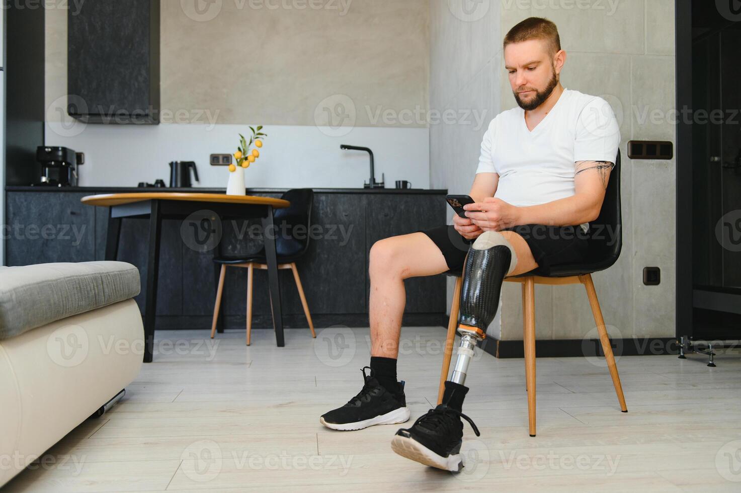 Man amputee with prosthetic leg disability on above knee transfemoral leg prosthesis artificial device, close up. People with amputation disabilities everyday life photo