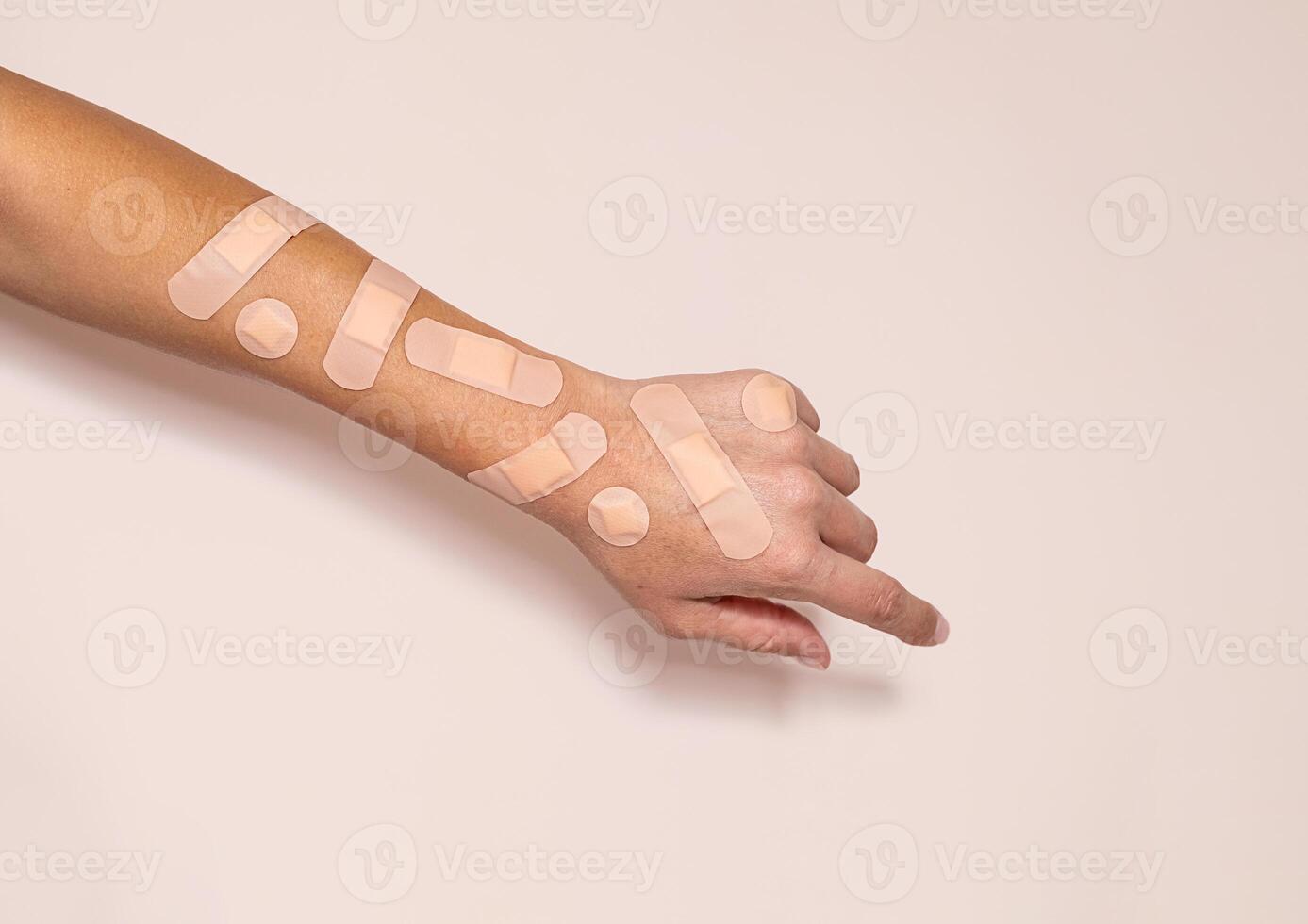 Human arm covered with various adhesive bandages. photo