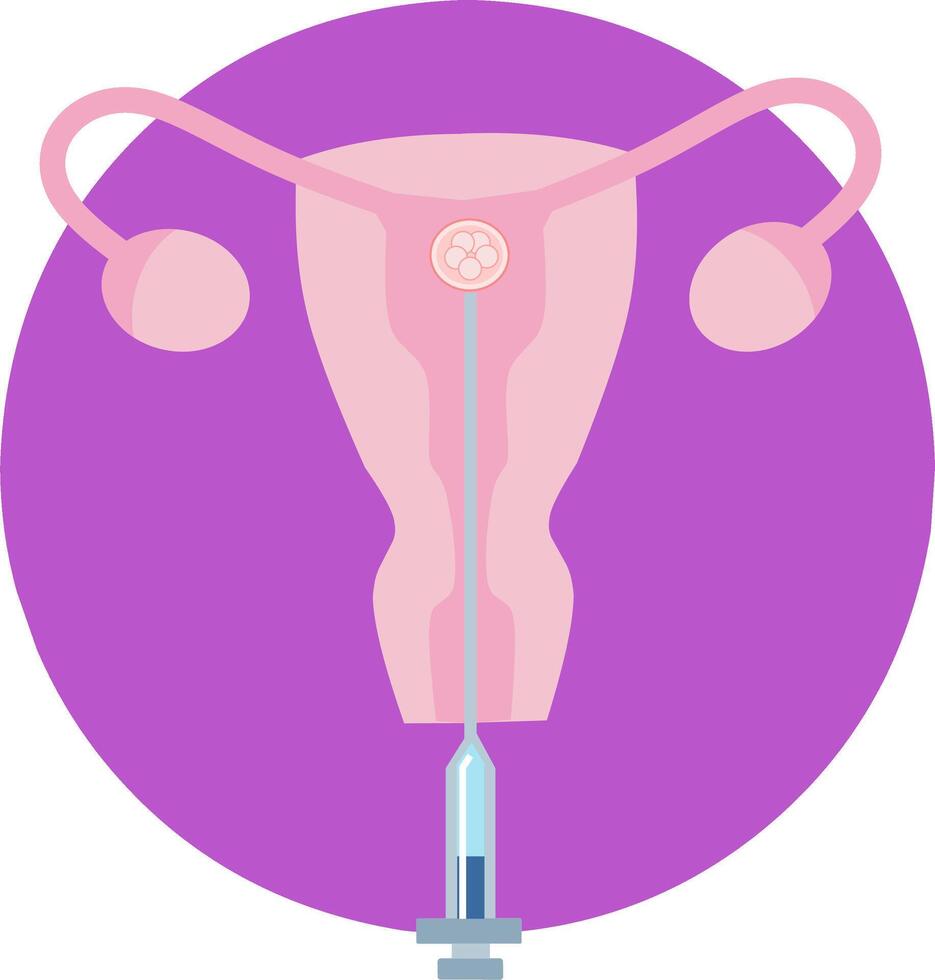 A woman's uterus with a needle and a syringe vector
