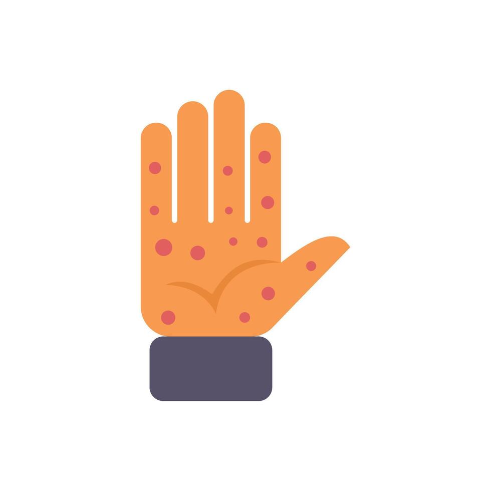 Hand showing symptoms of monkeypox virus infection vector