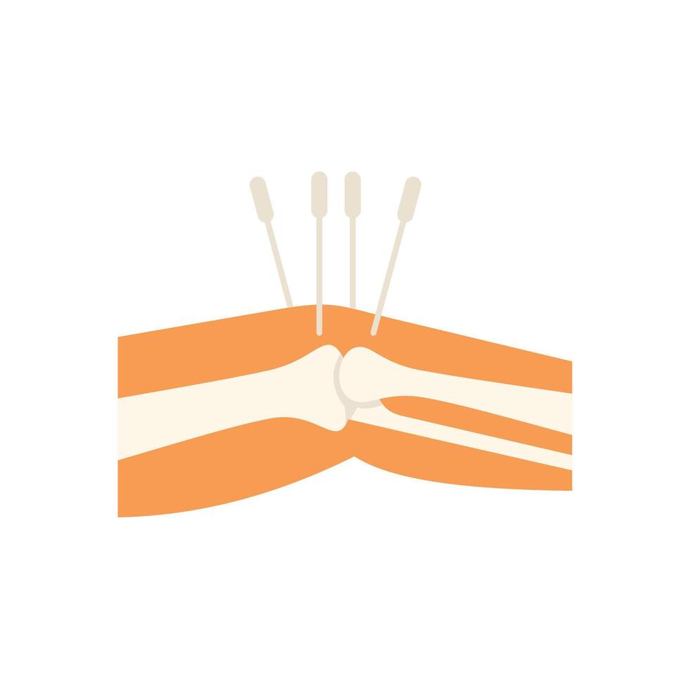 Acupuncture needles treating knee pain illustration vector