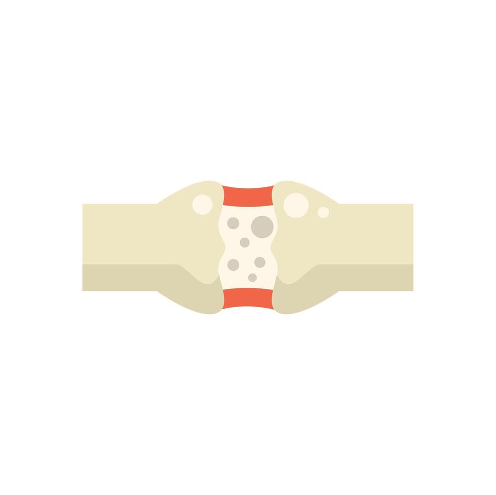 Human joint showing osteoporosis affecting bones vector