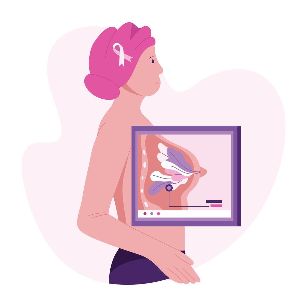 A flat character illustration of cancer diagnosis vector