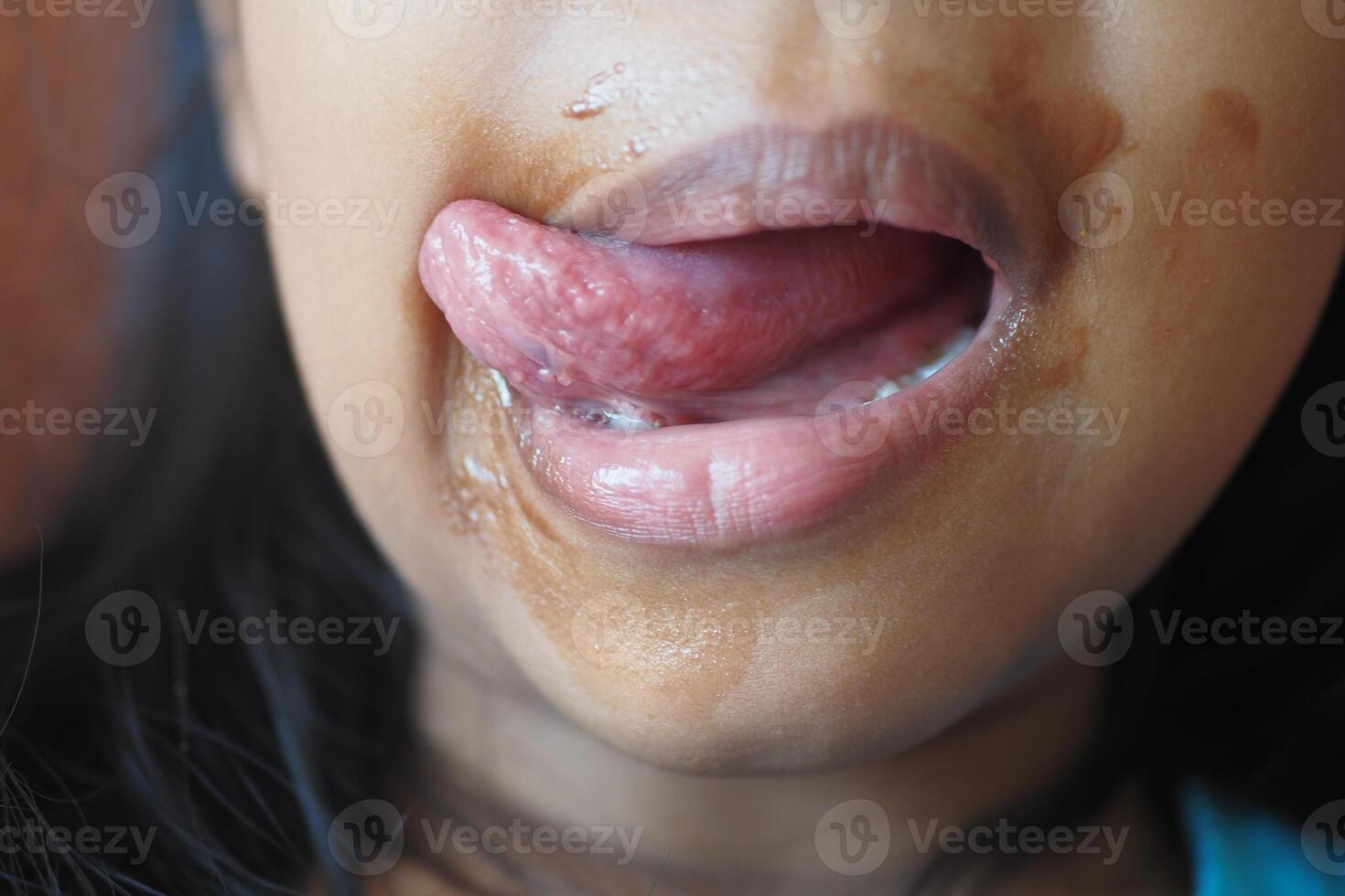 A CloseUp Photograph of a Childs Mouth with Their Tongue Out and Drool Dripping Down photo