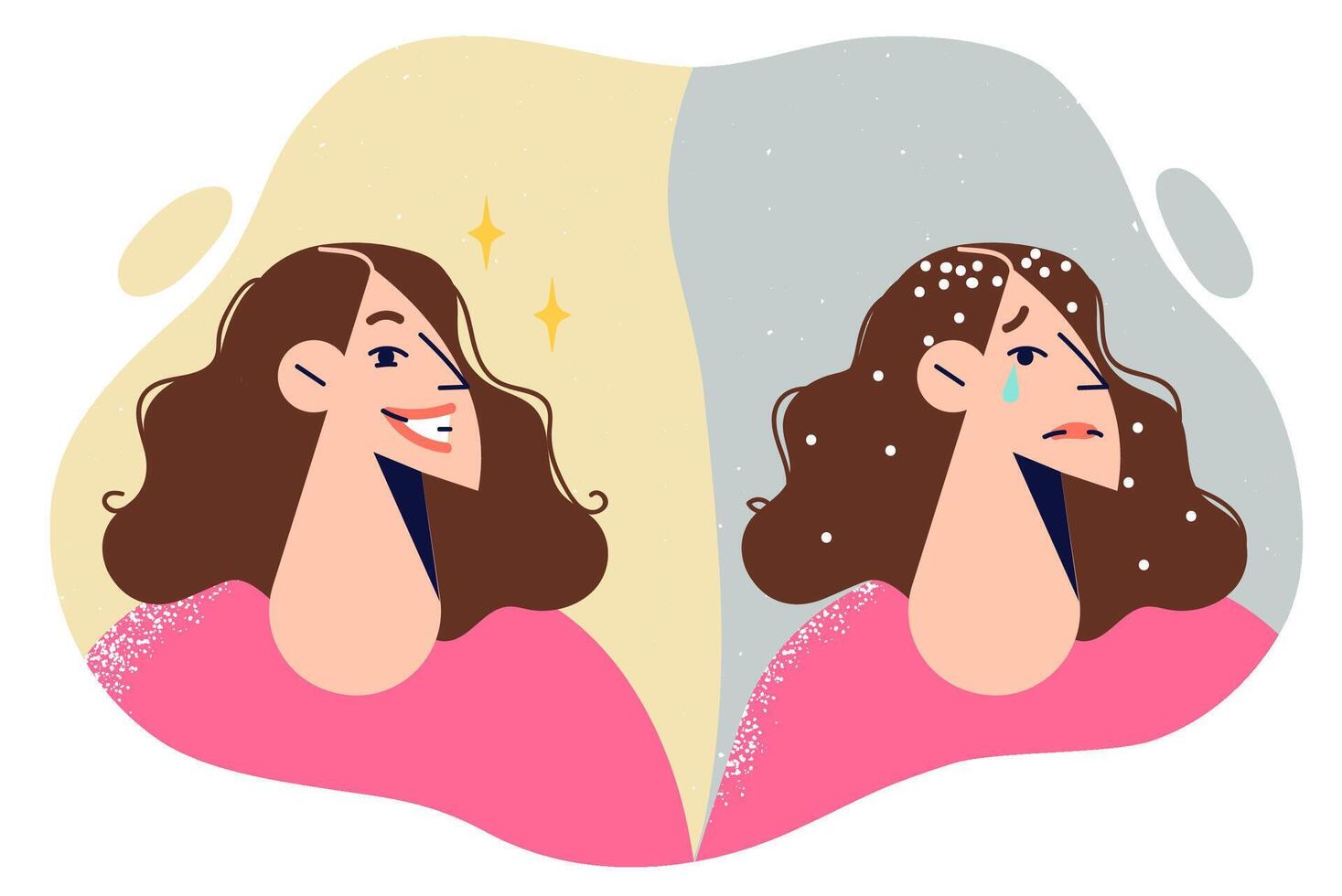 Dandruff appeared in woman hair due to problems with immune system or use of bad shampoo vector