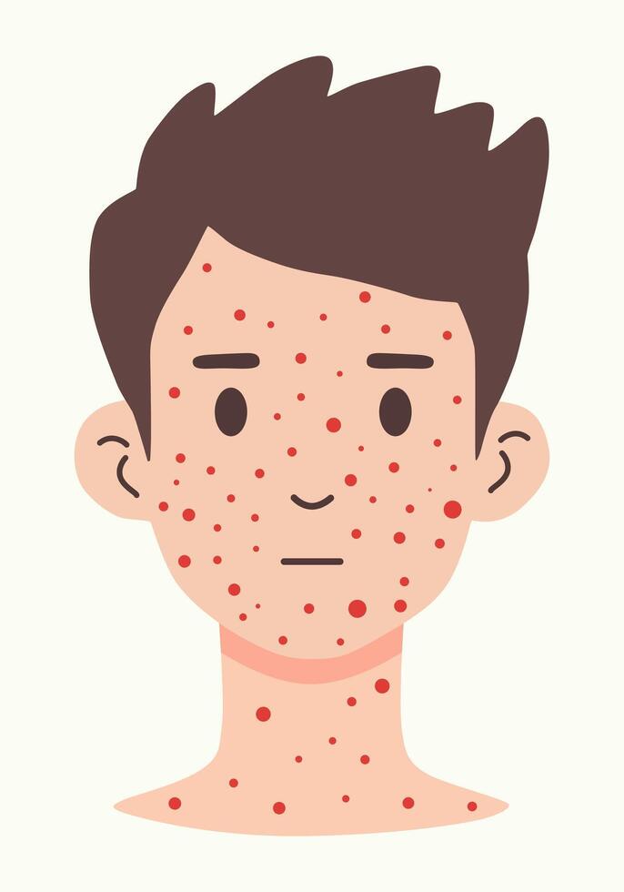 Illustration of a man's neck and face covered in red spots vector