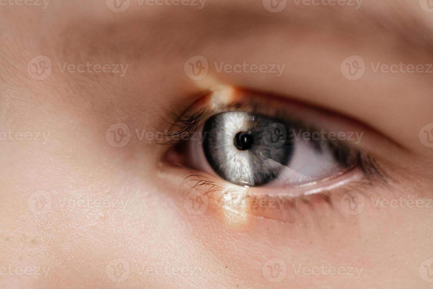 A little girl undergoes an eye test by a professional optometrist using modern diagnostic equipment in ophthalmology clinic. Beautiful female eye with yellow laser ray. Vision correction. Macro shot photo