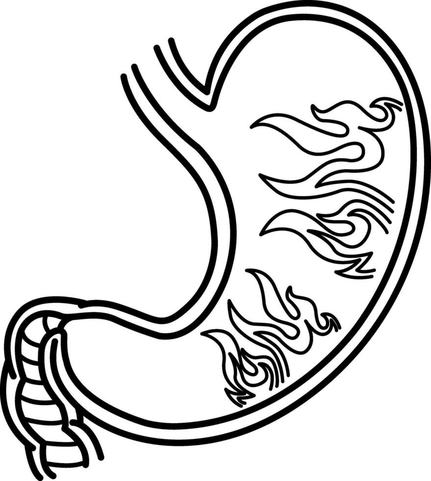 Gastritis of the Stomach for Coloring Pages. Heartburn concept. Illustration of a Human Stomach on Fire. Anatomy and Medicine vector
