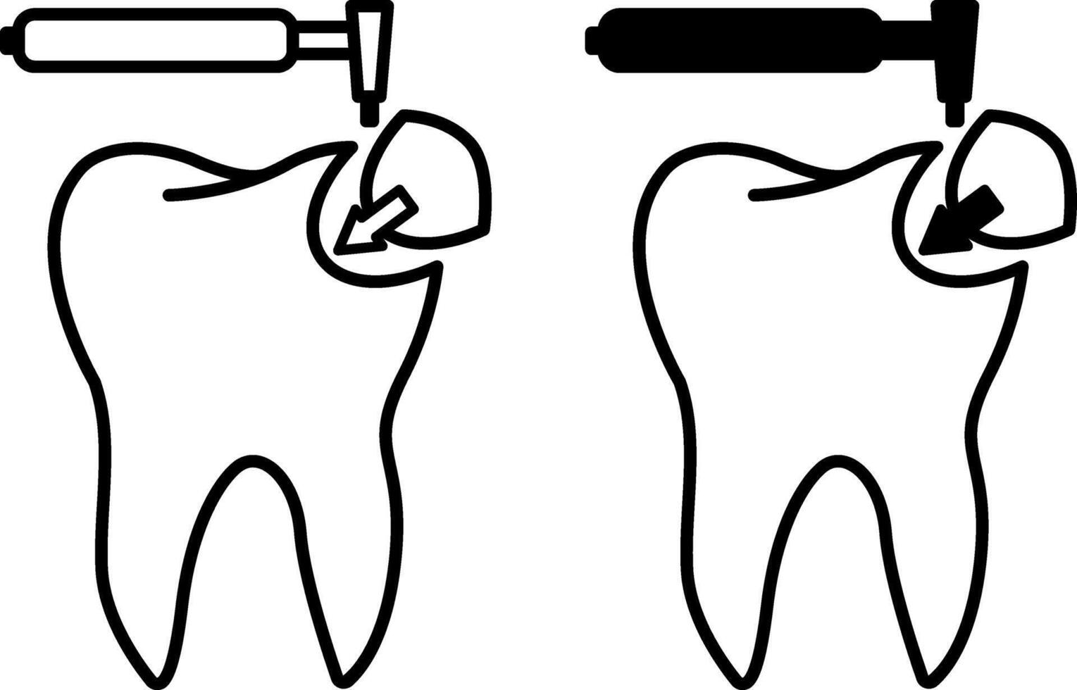 Dental Filling icons. Black and White Icons. Restoration of a Destroyed Tooth with a Composite Filling. Dental care and treatment. Medicine and Dentistry Concept vector