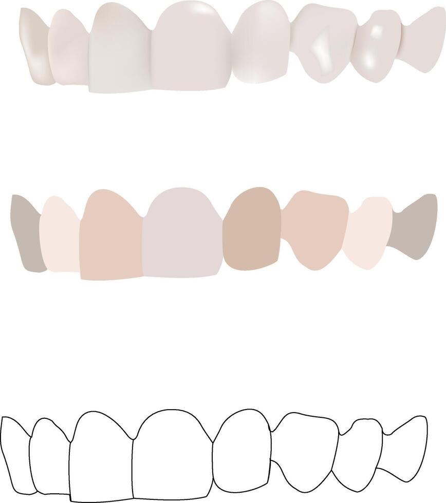 Set of teeth showing healthy teeth, unhealthy teeth and teeth contour vector