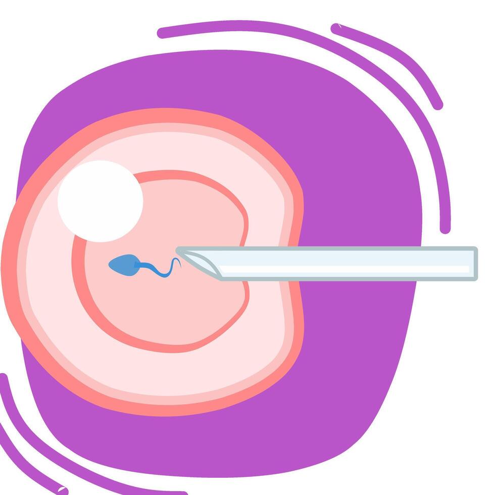 Ivf procedure illustration with purple background. Fit for science presentation. vector