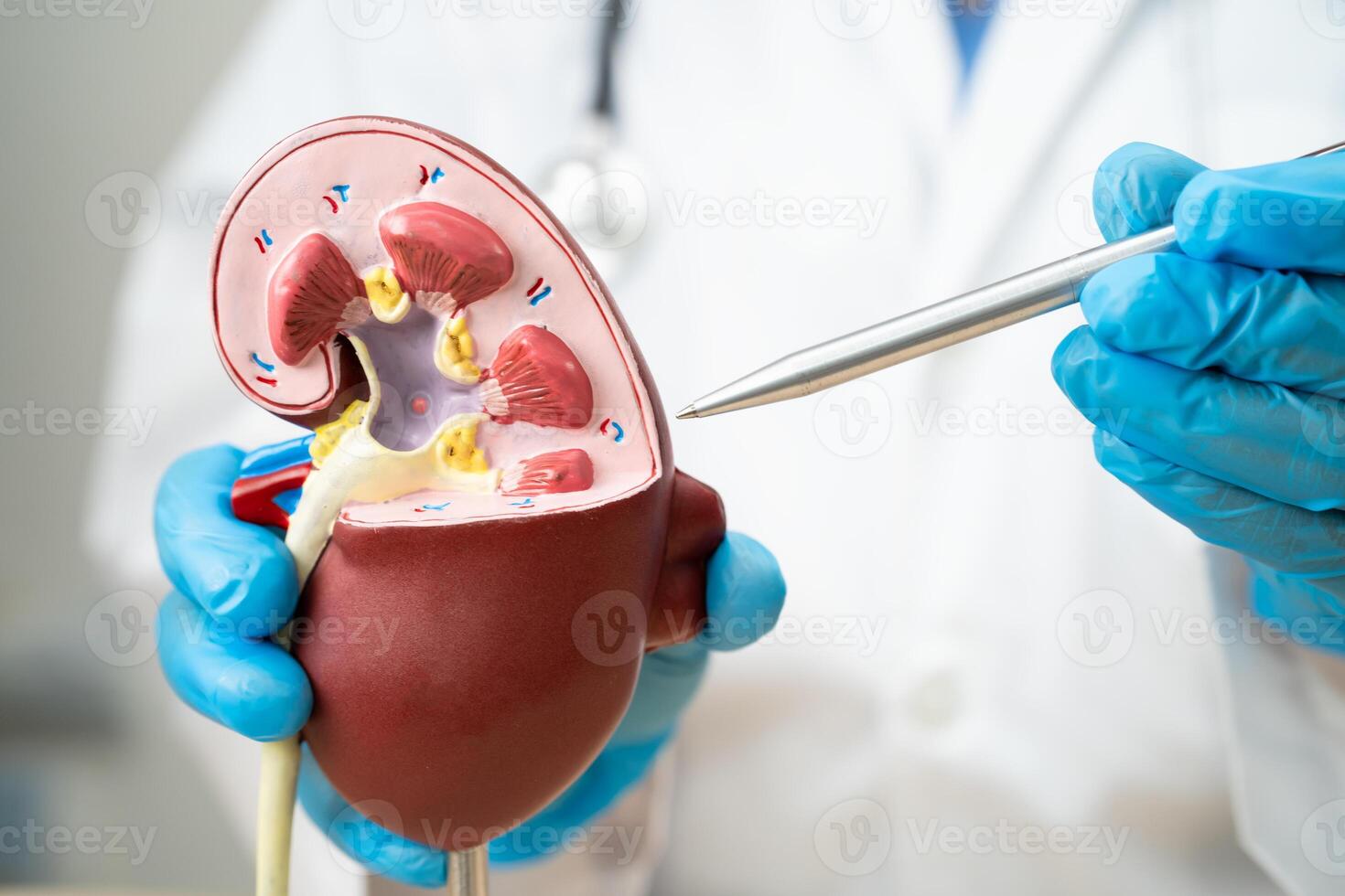 Kidney disease, Chronic kidney disease ckd, Doctor hold human model to treat and study in hospital. photo