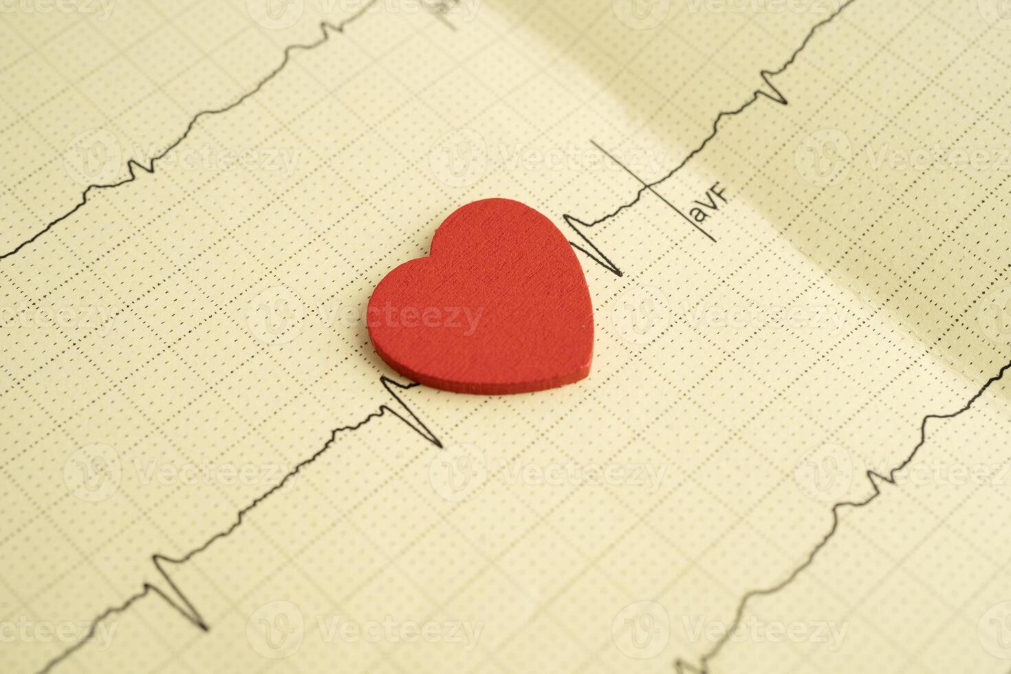 Electrocardiogram , heart wave, heart attack, cardiogram report. photo