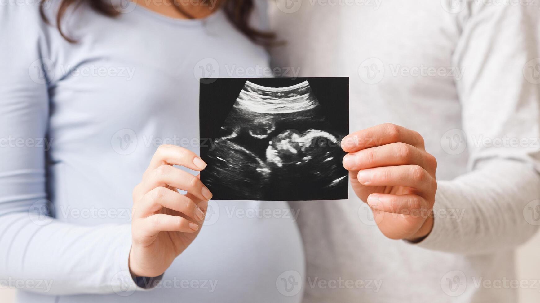 Birth Of New Life. Pregnant woman and her husband showing ultrasound scan of their baby, selective focus on hands with sonography photo