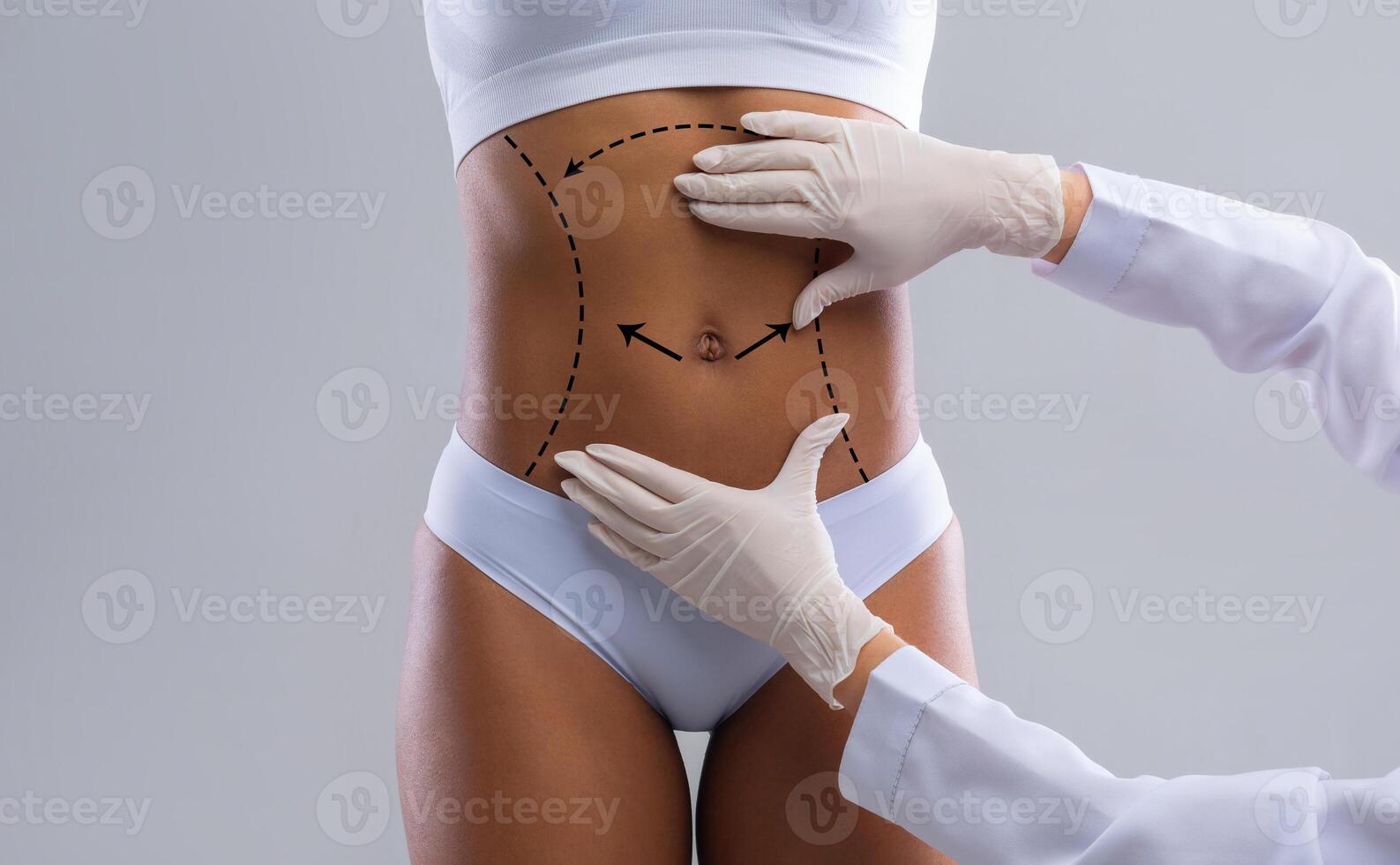 Cellulite removal plan. Doctor hands in gloves marking lines on young afro woman body, grey background photo