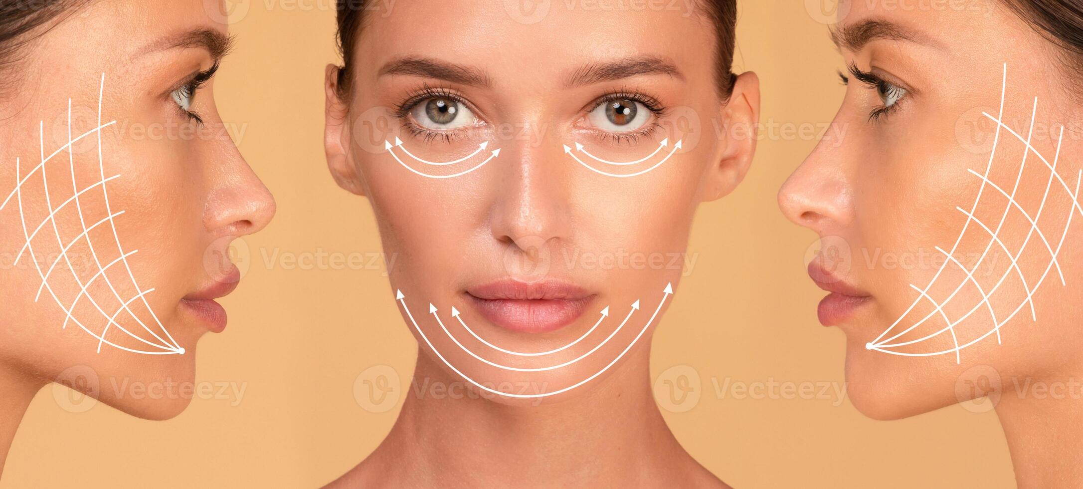 Cosmetology concept. Collage of front and side view portrait of caucasian young woman with arrows on face for lifting skin, panorama, cropped photo