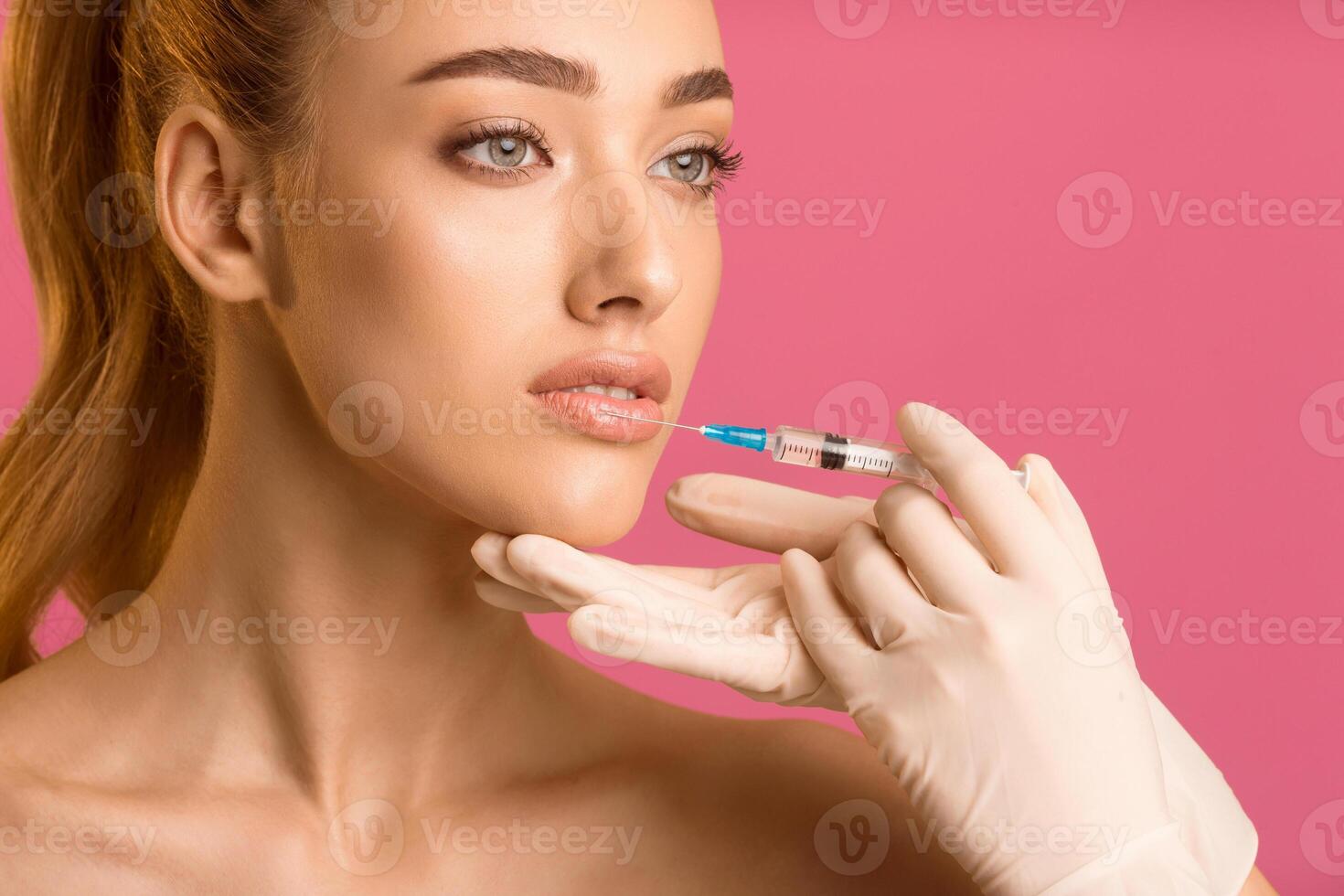 A young woman with long red hair is receiving lip injections from a medical professional wearing white gloves. The woman is looking to the side and the gloved hand holding the syringe photo
