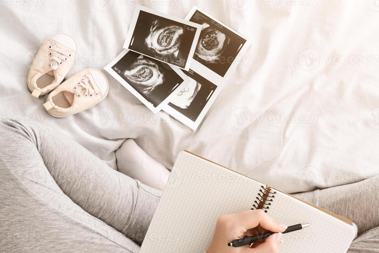 An expectant mother is sitting on a bed writing in a journal. Surrounding her are baby ultrasound images and a pair of tiny baby shoes, capturing a quiet moment of anticipation and planning photo