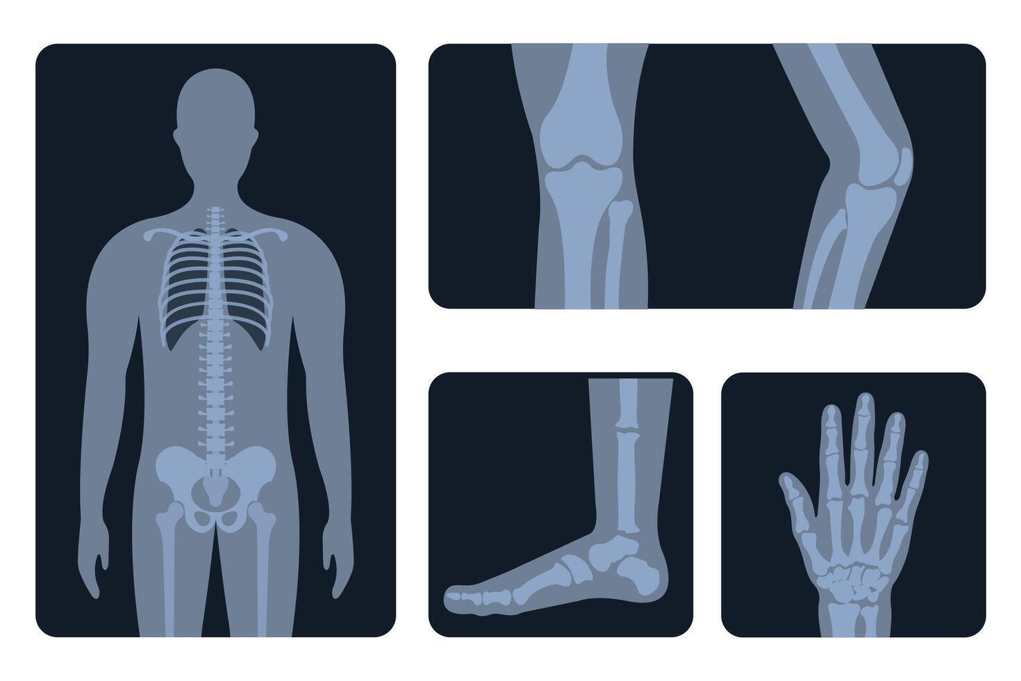 X-ray body parts. Human skeleton, knee, arm, chest, wrist concept, medical radiology imaging of bone injuries. vector