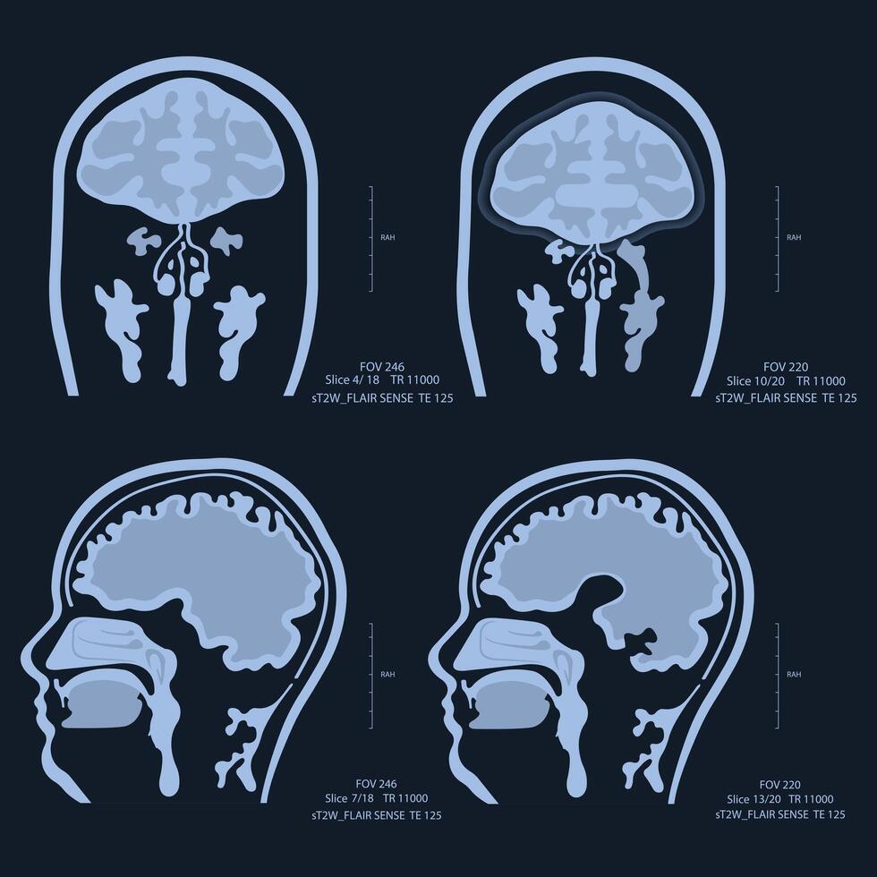 MRI - Magnetic Resonance Imaging - Illustration. X-ray images of the brain vector
