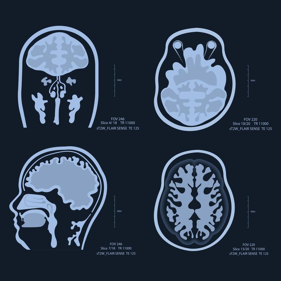 X-ray images of the brain, scanned with MRI or CT. Accept radiology vector
