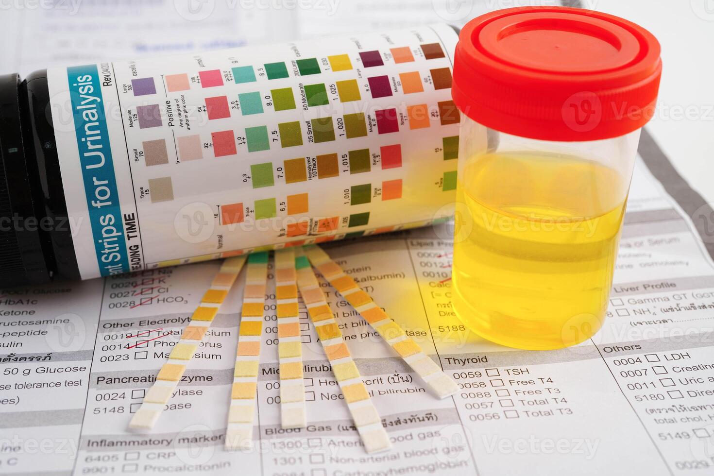 Urinalysis, urine cup with reagent strip pH paper test and comparison chart in laboratory. photo